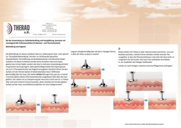 Beauty -Plasma-Point-  Spot-Remover  - Depilator - mit Fraktionsaufsätzen